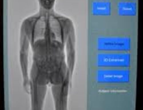 Sheriff’s Department implements body scanner